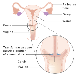 Cervix location